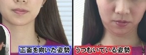 うつむいた姿勢→ほうれい線が出やすく